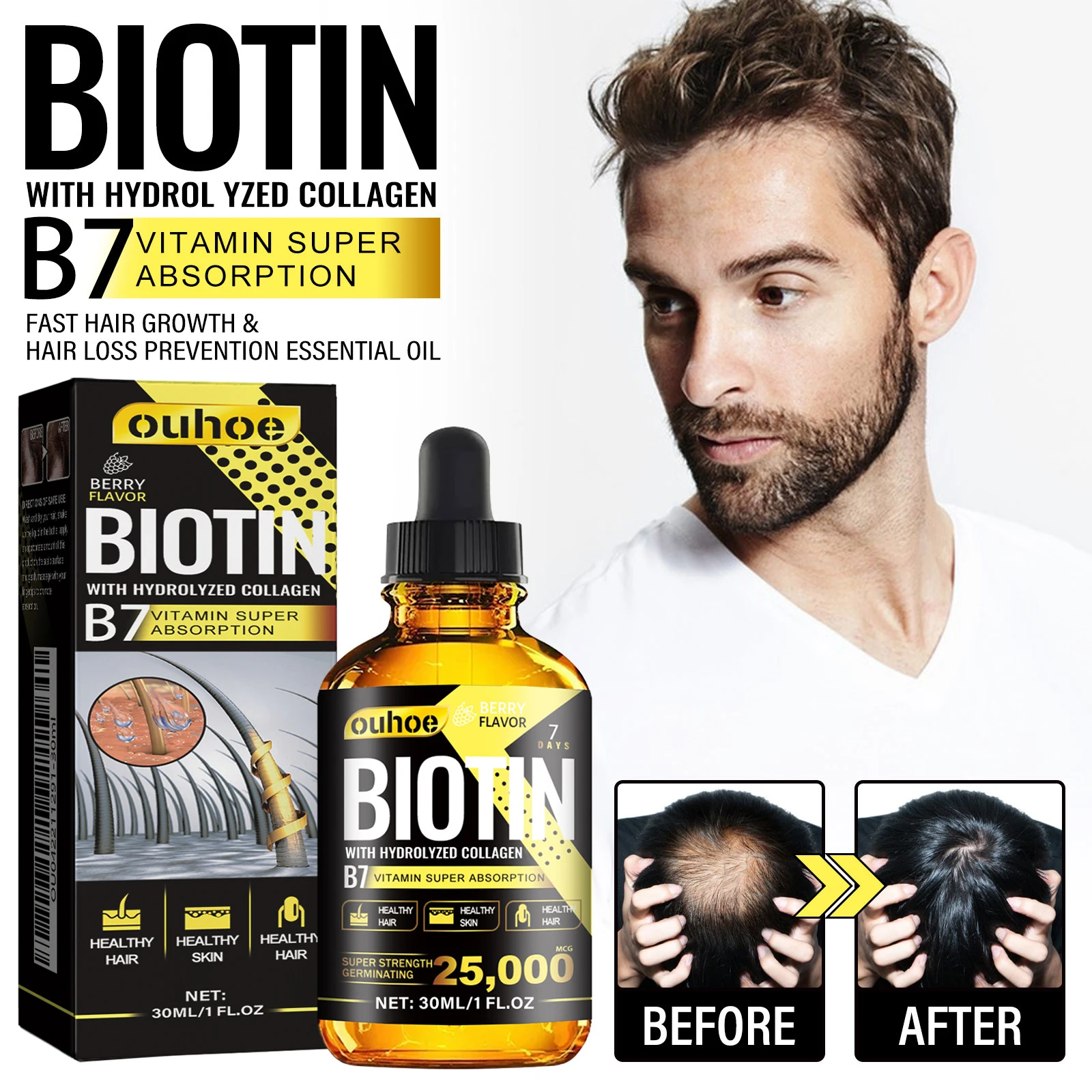 Biotin Hair Oil Collagen Scalp Serum Strengthening Treatment Natural Rosemary Ginseng Extract Thicker Hair Care Essential Oil