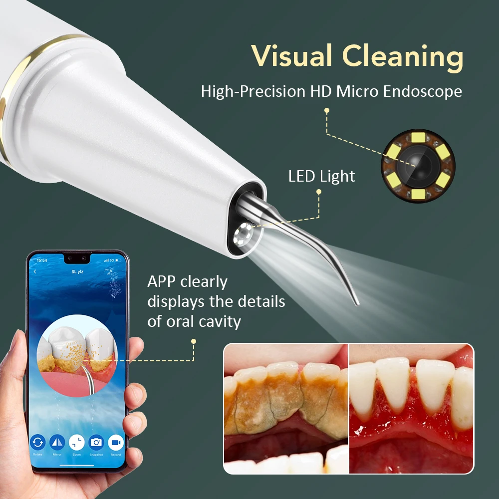 Limpiador Dental ultrasónico Visual con cámara, escalador Dental eléctrico, eliminador de sarro y cálculo, herramientas de limpieza para blanqueamiento Dental