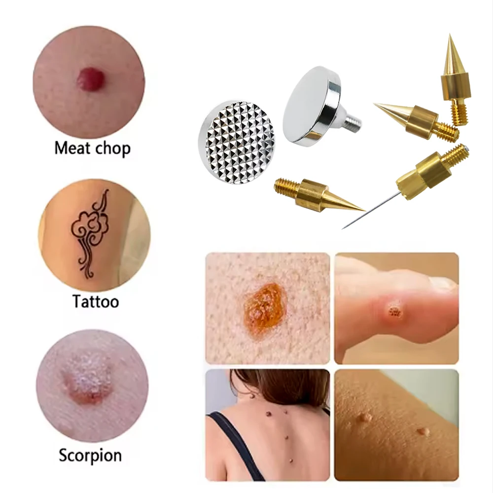 Copper Replacement Needle Tips for Plasma Fibroblast Pen Replacement Tips for Spot Freckle Mole Tattoo Removal Skin Care Device