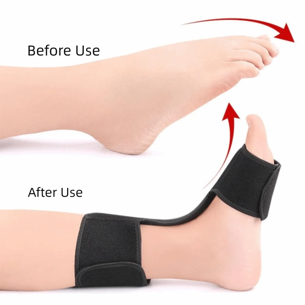 

Aluminum Bar Support Foot Splint Brace Elastic Adjustment Dorsal Drop Foot Orthopedic Brace Skin-friendly Comfortable