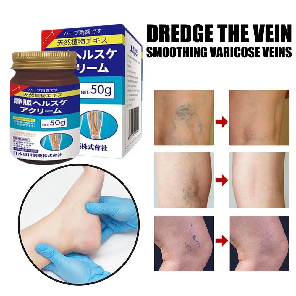 Japan Dongtian Vein Health Cream Repair Venous Discomfort Relieves Soreness Swelling Deep Nourishment And Repair 1pcs