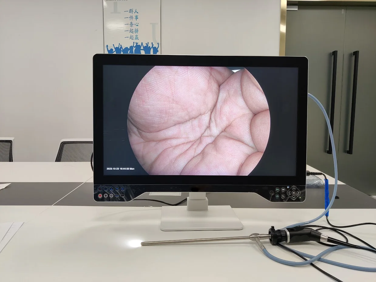 Tuyou 32''  Portable Rigid Medical Video Endoscopy Camera System Come with LED Light Source for Laparoscopy Urology