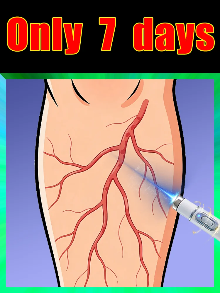 Help people with vein problems caused by prolonged standing. Restore operational capability No side effects