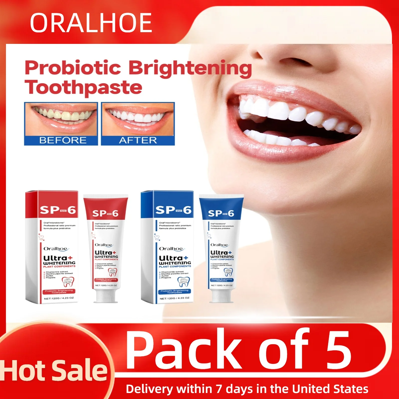 5pcs SP-6 Probiotic Whitening Toothpaste Oral Hygiene Cleansing Deodorizes Fresh Breath Removes Teeth Stains Whitening Teeth Car