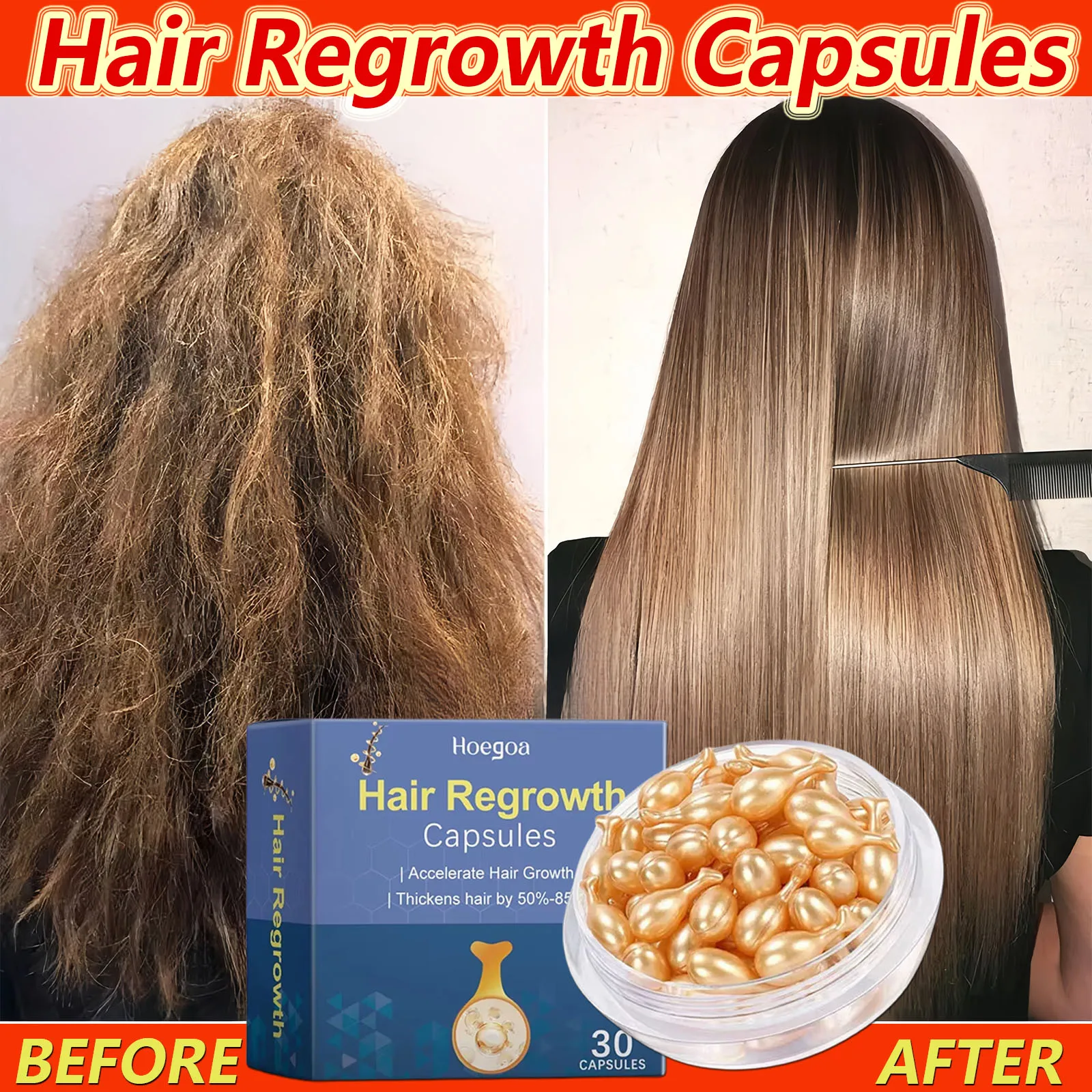 

Hair Growth Serum Fast Regrowth Essential Oil Capsule Anti Hair Loss Baldness Repairing Damaged Scalp Treatment For Women Men