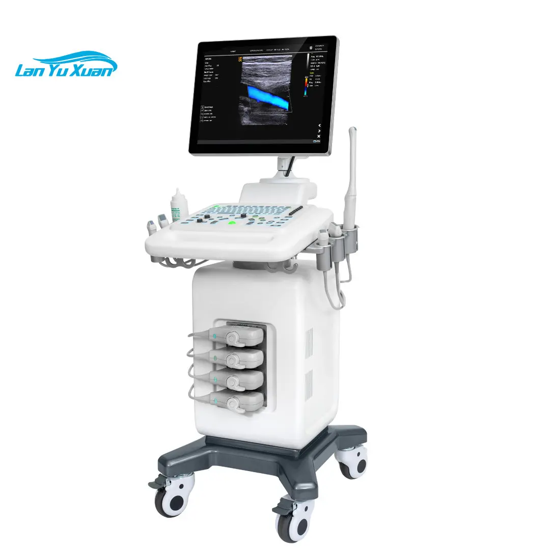 3D/4D Echografie Machine Fysiotherapie Kleur Doppler Ultrasound Scanner Machine Draagbare