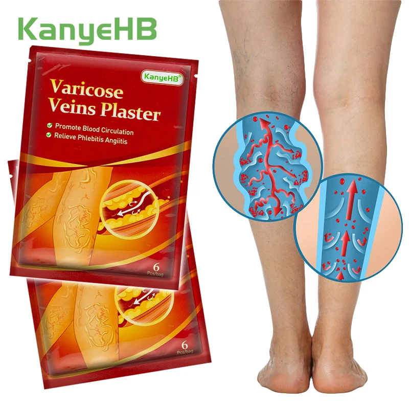 

12pcs=2bags Varicose Veins Medical Patch Improve Blood Vessel Veins Swelling Pain Relief Plaster Varicosity Treatment Patch A593