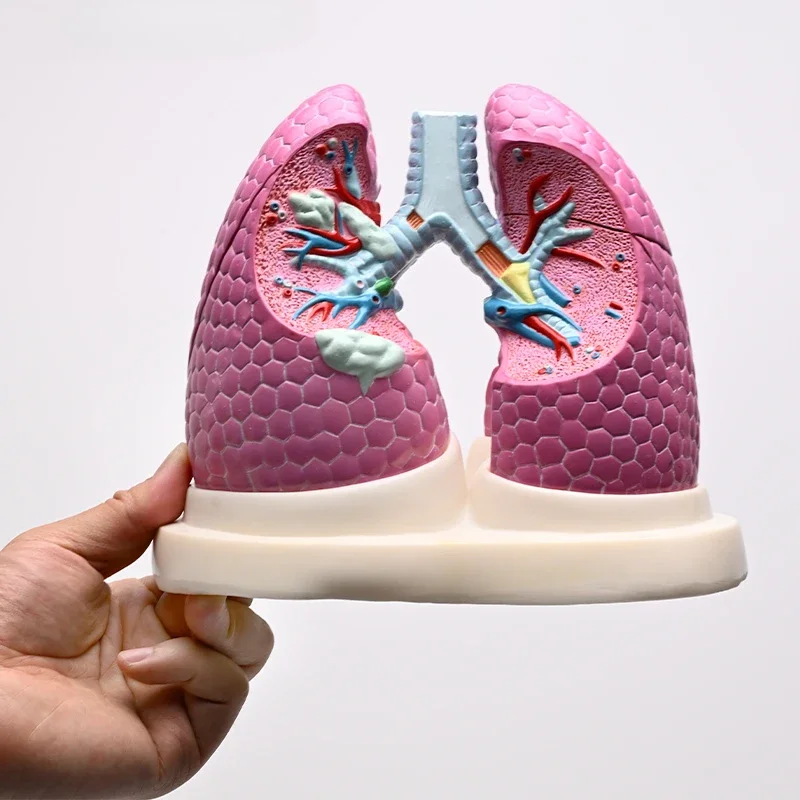 Comparative anatomical model of normal lung disease