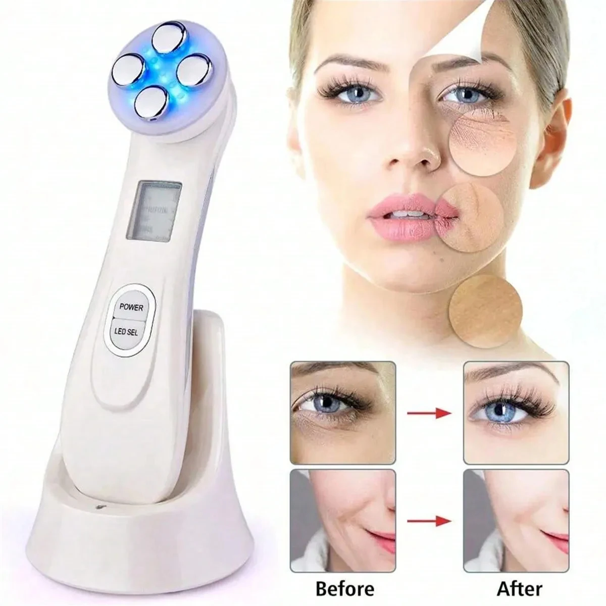 Dispositivo de belleza Facial Rf con tecnología de iones de luz Led para estiramiento de la piel, levantamiento, brillo, cuidado Personal del rostro en casa