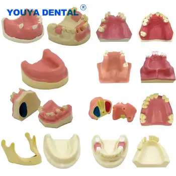 植牙實踐模型:下顎竇軟性牙齦模型,適用於牙醫學生訓練教學示範診所模型 8 最佳銷售 牙醫學生 - №3