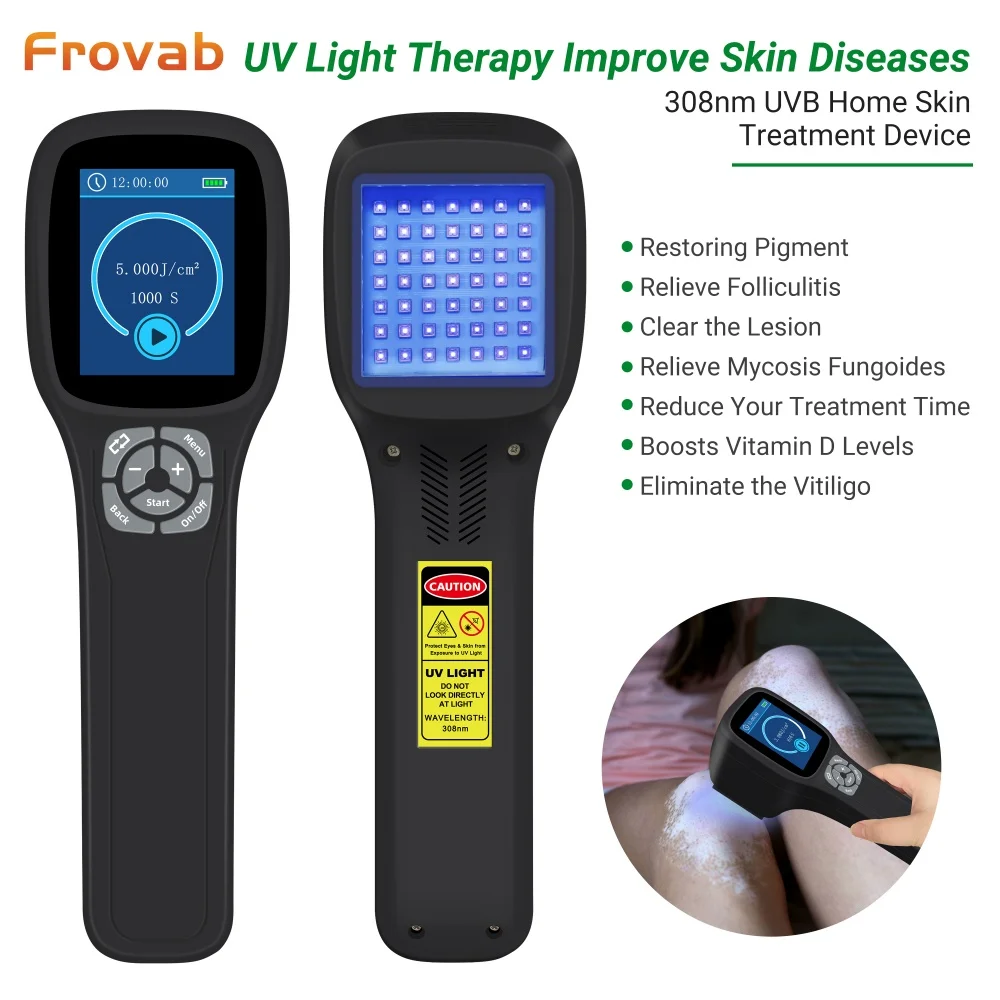 

Frovab 308nm UVB Light Therapy Machine 49pcs Diodes Portable Phototherapy Lamp Vitiligo Psoriasis Eczema Ultraviolet Treatment