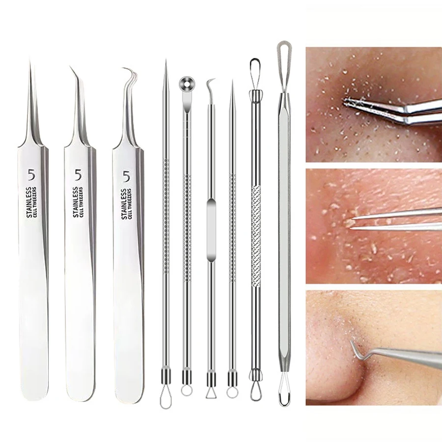1/4/9 pçs acne cravo agulha ponto preto espinha mancha removedor cuidados com a pele beleza feminina acne cuidados poros limpador agulha gancho, ing