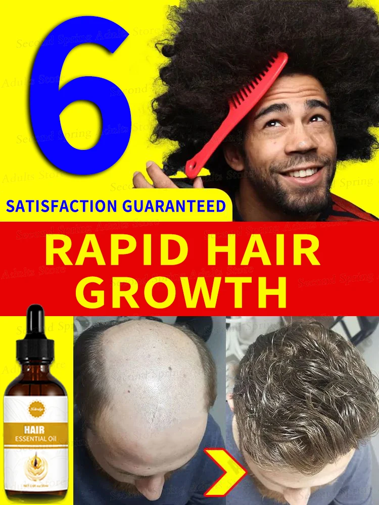 

Solutions for Thinning Hair