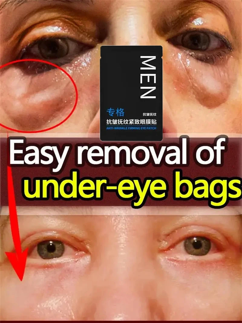 Eyes Bag Remove Collagen Eye Patch Instant Fade Fine Lines Dark Circles Fat Particles Moisturizing Anti-Puffiness Korea Eye Care