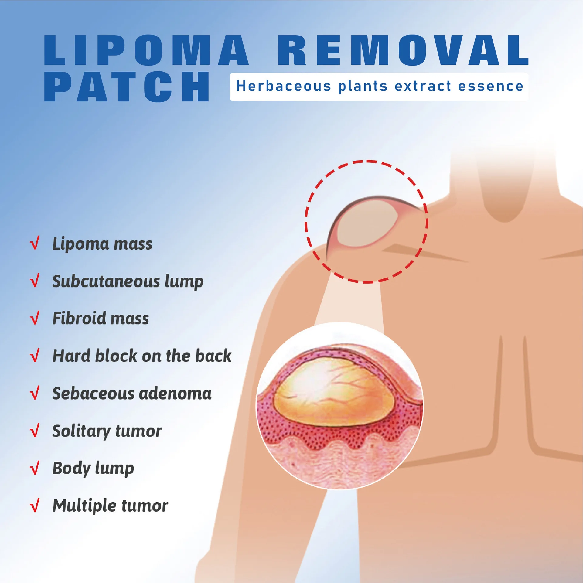 BUPY Patch per la riparazione del nodo grasso lenisce i grumi sottocutanei Patch per la cura della dissoluzione del nodo grasso