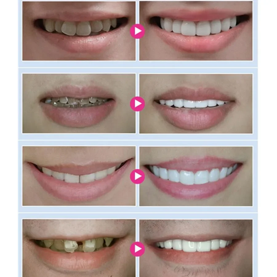 3ml Dental Oral Teeth Teeth Whitening Pen Tooth Gel Whitener Bleaching System Stain Eraser Cigarette Smoke Remove Instant