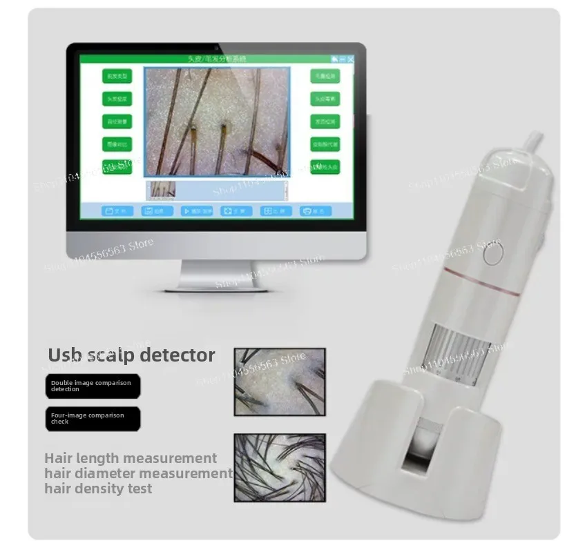 High Definition Scalp Hair Detector  Beauty Salon Hair Follicle Analysis Detector