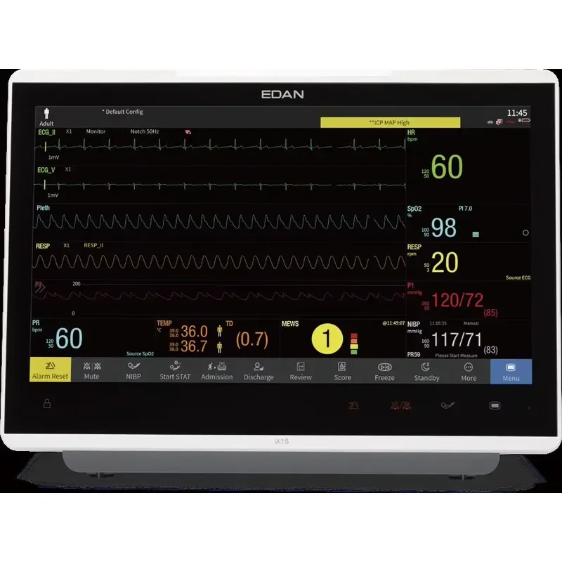2026 New, High Quality, Edan IX Series Veterinary Patient with HD Wide Touch Screen, Gesture Control, NIBP SpO2
