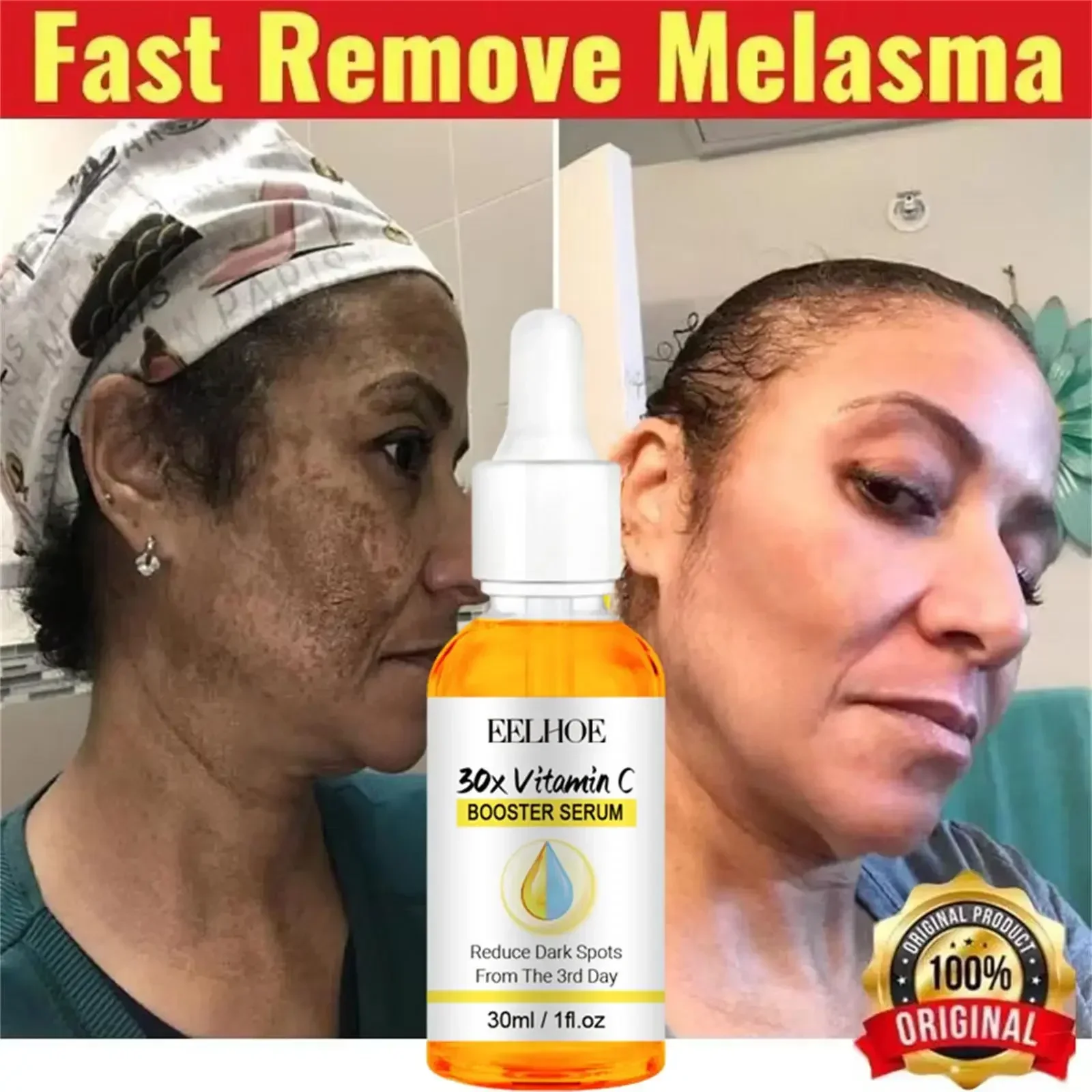 VC – evropum pour le visage, blanchissant les taches de rousseur, Alem, élimine les taches foncées, estompe laúnlanine