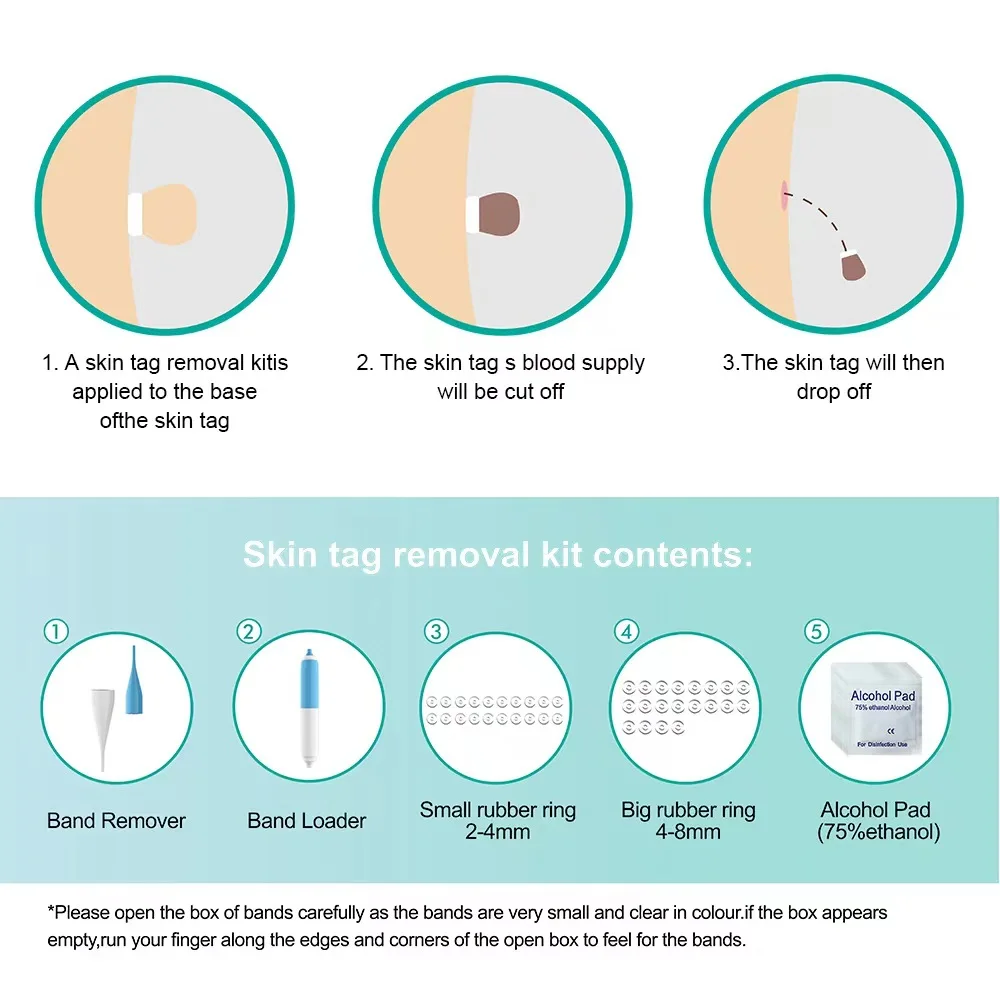 مجموعة واحدة من أقلام إزالة الثآليل من الجلد التلقائي، مجموعة أدوات إزالة علامات الجلد الفعالة وغير المؤلمة