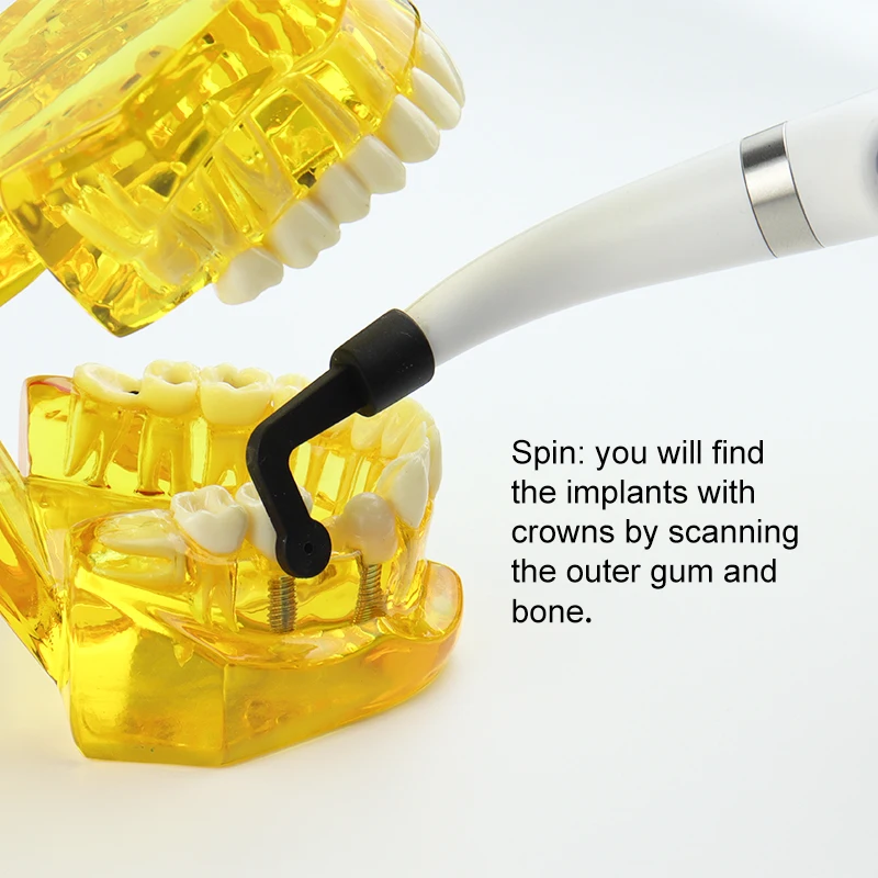 VV Dental Implant Locator Quick and Convenient Positioning for Find Implant Screw Dentistry 360 Rotatable Sensor Localization