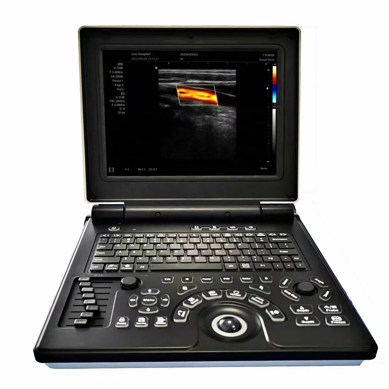 Ultrasound Di ag-  -no stic Echo Machine 3D Color Doppler Small  Ani mal Pet Note book