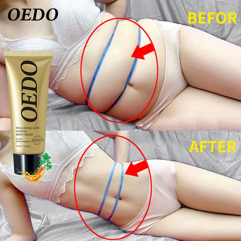 Slimming Cream Burning Creams OEDO Hyaluronic Acid Ginseng Fat Burning Remove Cellulite Lose Weight Slim Body Healthy Slimming