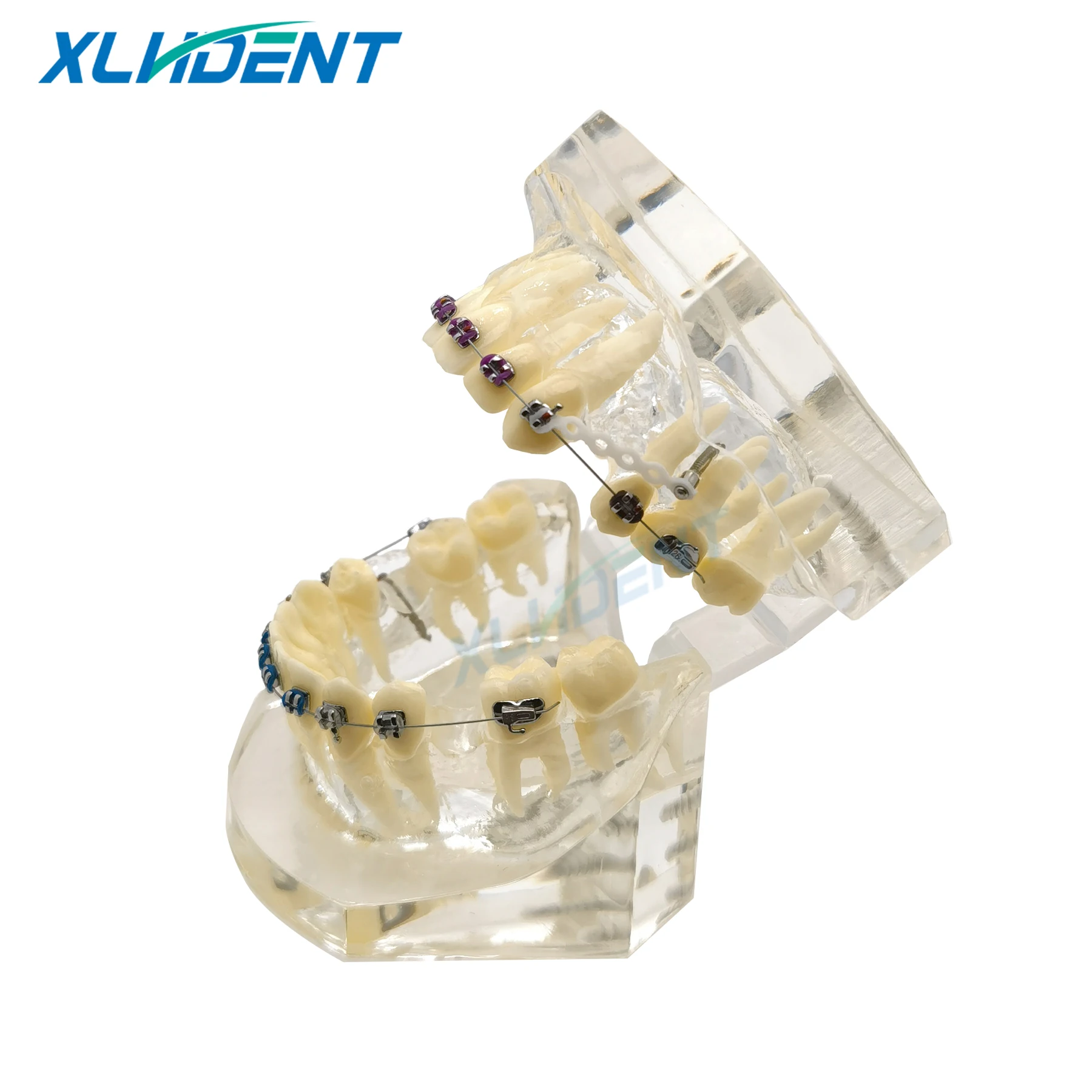 نموذج طب الأسنان مع قوس تقويم الأسنان للطبيب المريض الاتصالات علاج طبيب الأسنان نموذج مظاهرة نموذج طقم أسنان