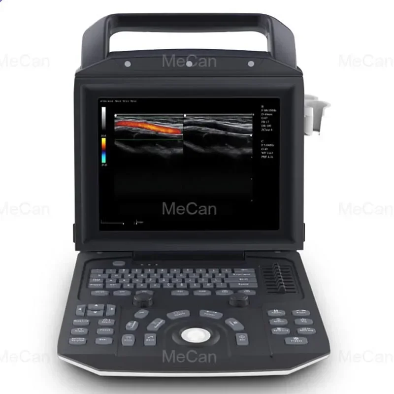 Medical Ecografo Echo Portable 3D Color Doppler Ultrasound Echocardiography Machine Portable Ultrasound Scanner for Human Being