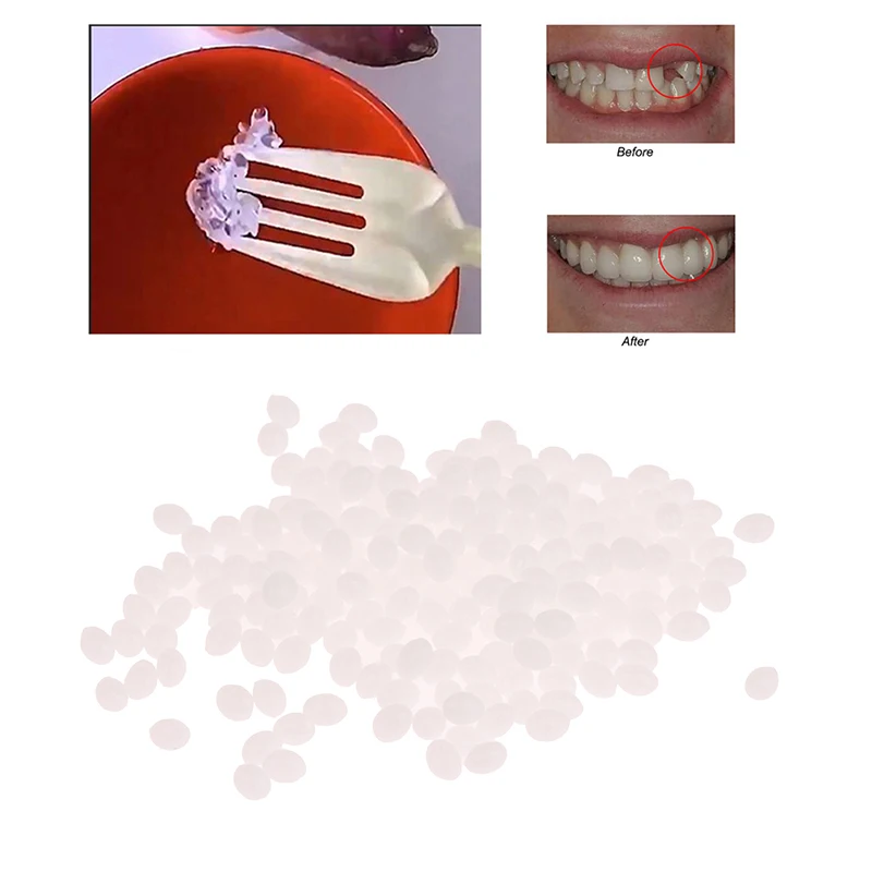 

[WHB]30ml Resin Tooth Repair Glue Shapeable Teeth Gaps Filling Solid Temporary Teeth Repair False Teeth Glue Safety