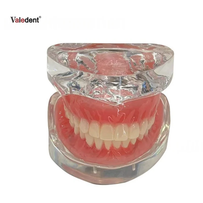 Dental Study Teach Mode Implant Teeth Model Dentistry Overdenture Removable Bridge 4/2 Implants Restoration Demonstration