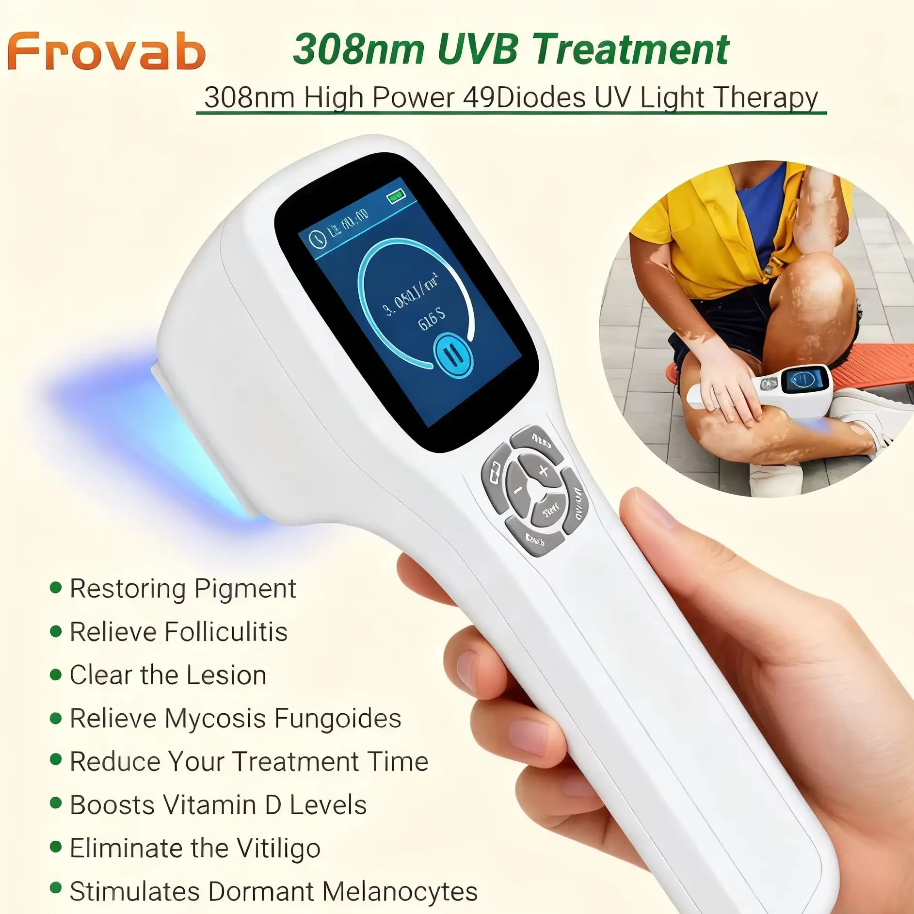

Frovab 308nm UVB Ultraviolet Phototherapy Equipment 49 Diodes Portable Light Therapy Lamp Psoriasis Vitiligo Eczema Treatment