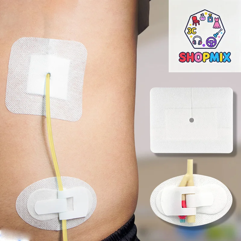 

5 шт. дренажная трубка, стерильный аппликатор, катетер для перитонеального диализа, желчный воздуховод, нефристомия, гастрочная трубка, дренажная трубка с наклейкой на отверстие