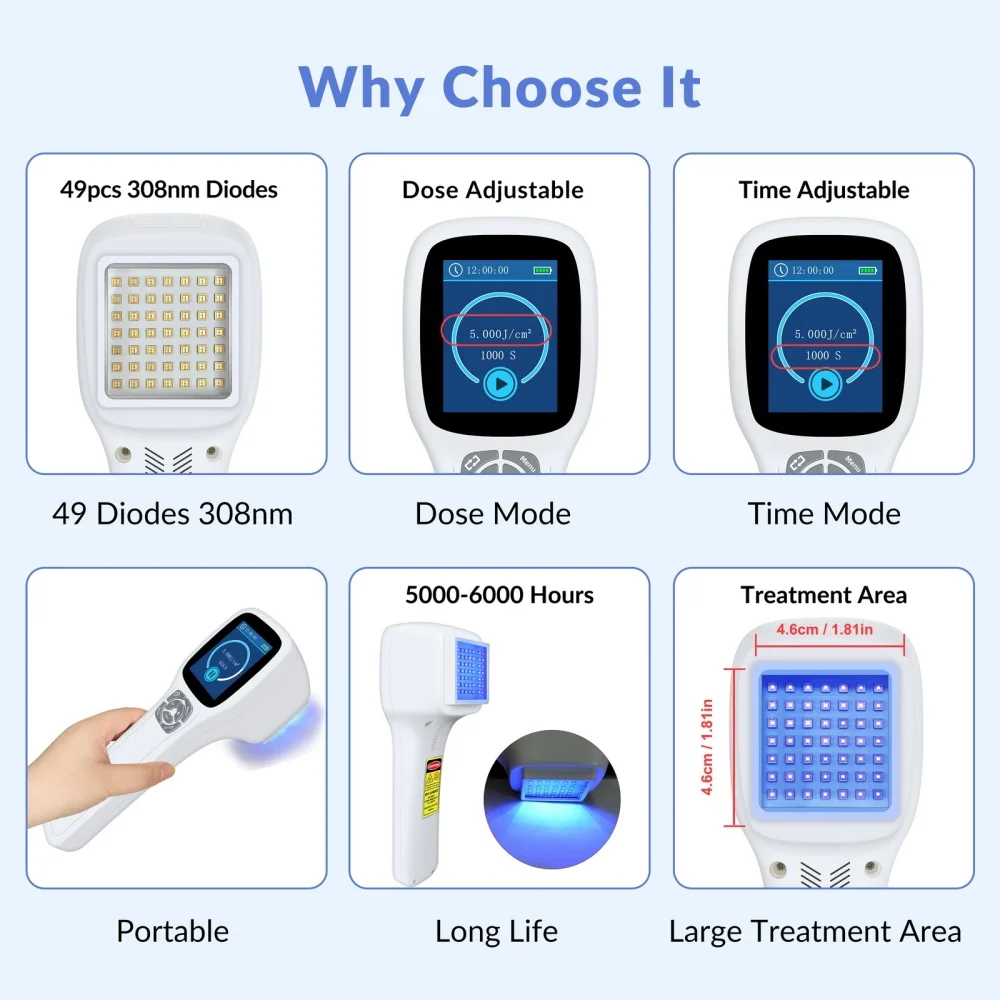 GOVW Portable 308nm UV Light Therapy UVB Phototherapy Instrument for Vitiligo Psoriasis Chronic Dermatitis Skin Spots