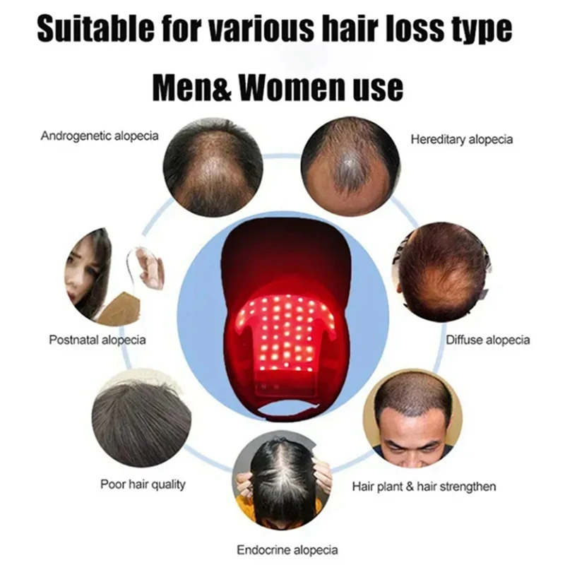 Instrumento infrarrojo para el crecimiento del cabello, gorro de cabeza de fisioterapia, láser, luz roja y azul, dispositivo para el cuidado del cabello, terapia de relajación