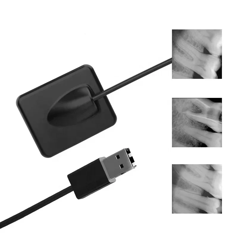 

Dental root canal measuring instrument apex locator Fast delivery