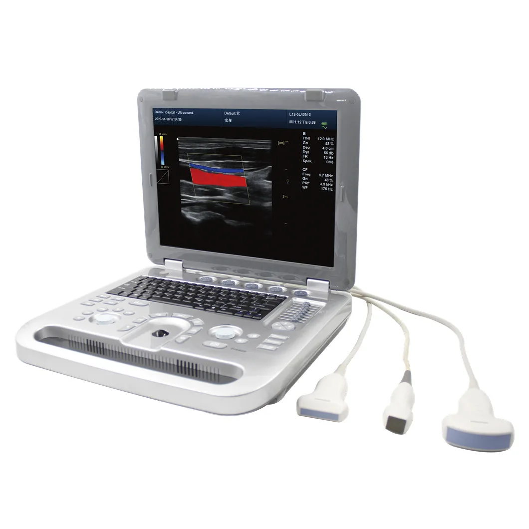 New Technology Portable Laptop Color Doppler abdomen heart peripheral vessels Ultrasound Machine