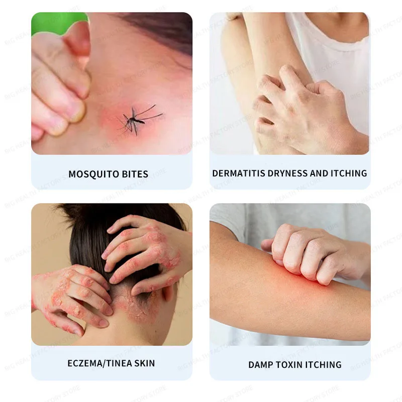 Lithospermum anti-itch cream for skin redness, swelling, dryness, itchiness, mosquito bites, diaper rash, and skin discomfort