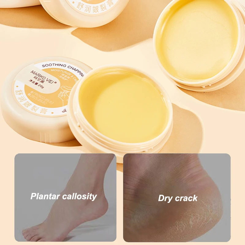 Crema antisecado para pies agrietados, crema reparadora para talón, eliminación de piel muerta, cuidado de manos y pies, 20g