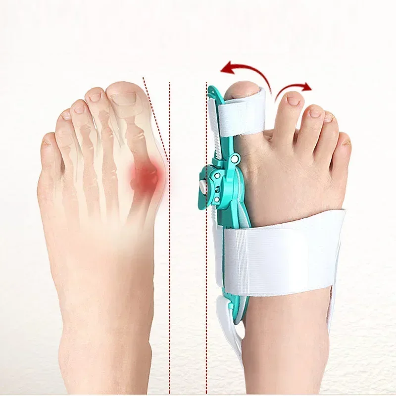 Corrector de Hallux Valgus, separadores de dedos del pie para juanetes, separador Haluksy del dedo del pie, Corrector de juanete, separador de dedos Halux Valgus