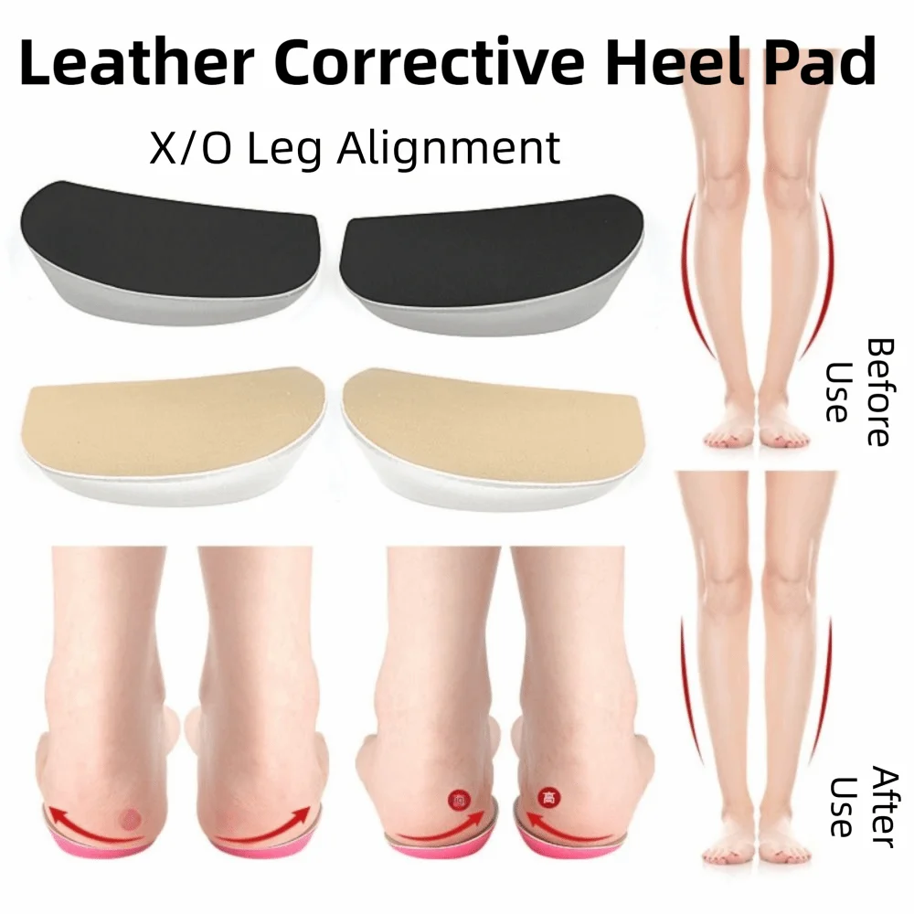 Silicone Gel Orthopedic Insoles Medial Lateral Arch Support Heel O/X Legs Corrective Insoles Valgus Varus Correction Flexible