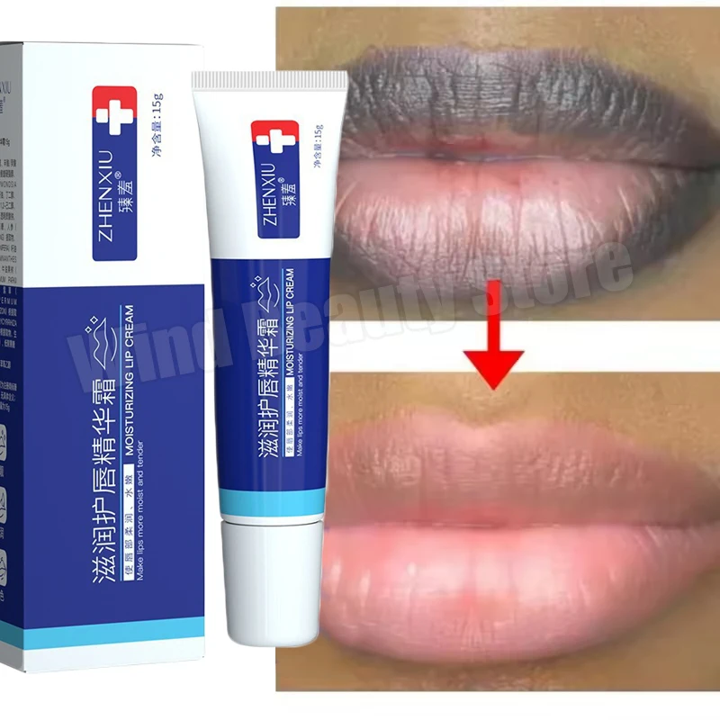 

Lip Balm Whitening Remove Dark Lighten Melanin Lip Mask Fade Lip Line Brighten Exfoliating Moisturize Dead Skin Repair Lip Care