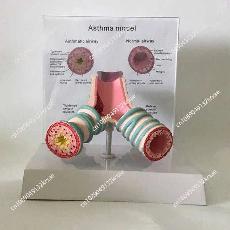 

Анатомическая модель человеческой трахеи Реалистичная анатомическая модель бронхиса с держателем