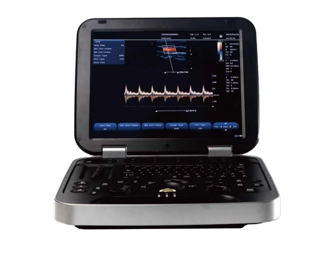 

laptop color dopplor ultrasonic diagnostic usg ultrasound machine medical ultrasound machine