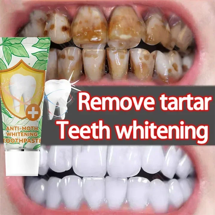 Whitening Tandpasta Verwijdering Plak Vlek Paarse Corrector Tanden Glazuur Zorg Gemakkelijk Verminderen Vergeling Orale Schone Verzorging