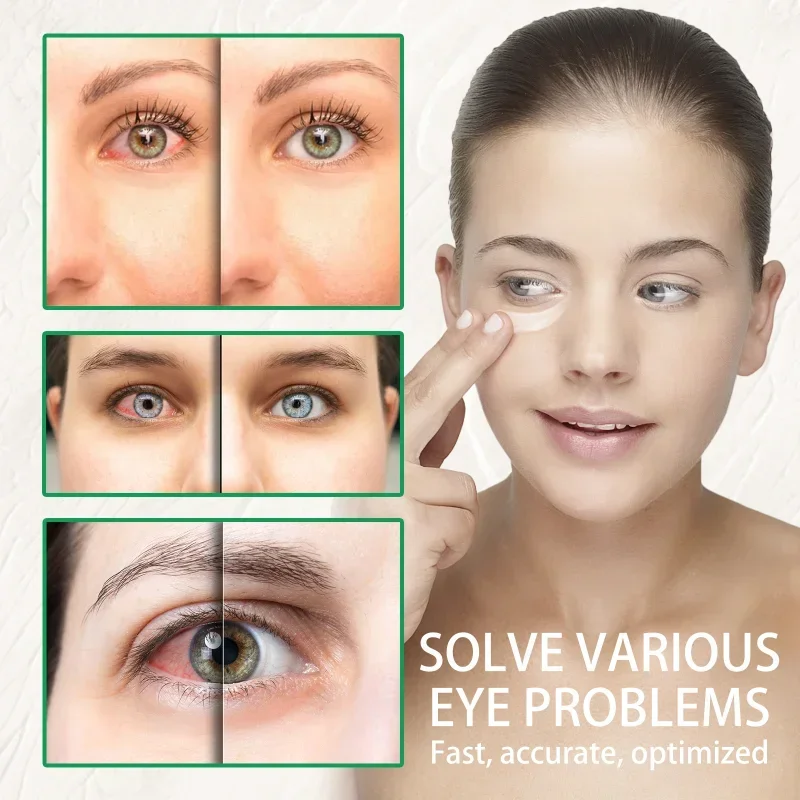 Eye Cream Protection vision Relief fatigue Itchy Dry Eyes At Night Remove Red Blood silk Moisturizing Bright Eyes care Ointment