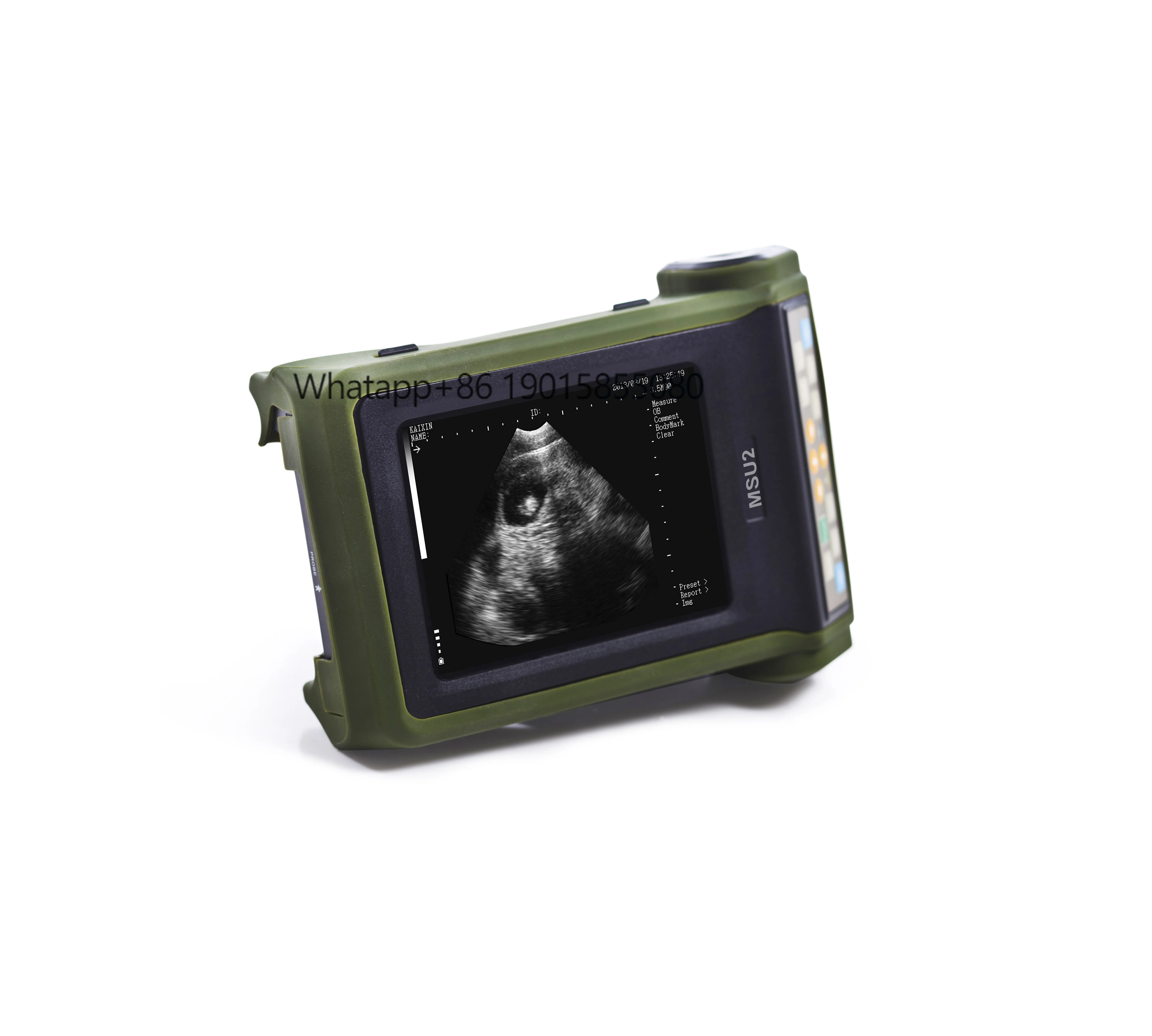 

Full Digital Veterinary Portable Ultrasound Scanner Ultrasonic Diagnostic Instruments for Animal