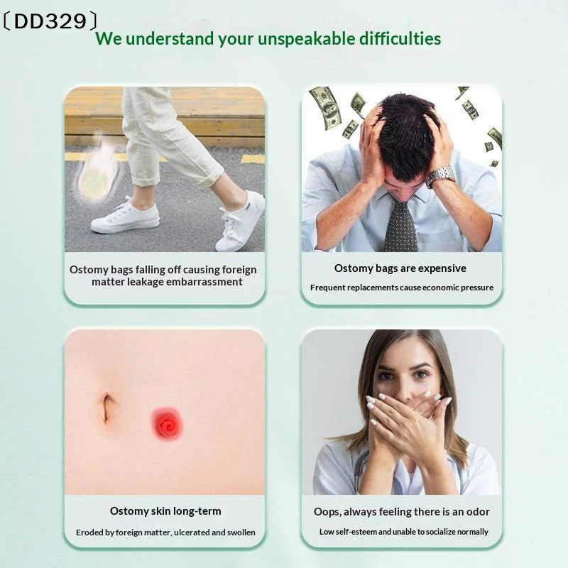 10 PCS Colostomy Bags Stoma Pouch Bags One-piece Open Ostomy Bags With Clips Translucent Colostomy Bag Stoma Care〔DD329〕