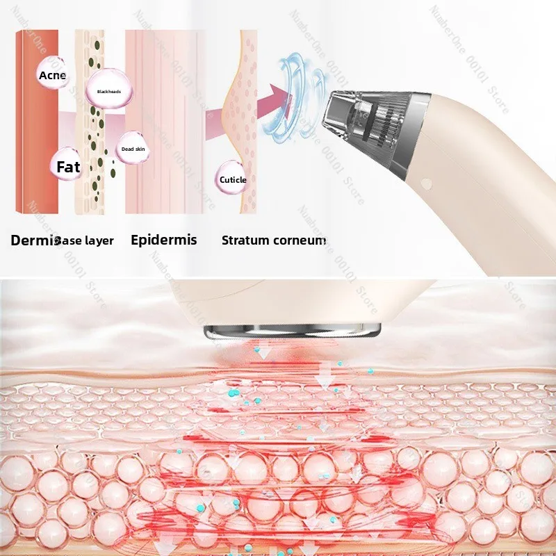 Facial Beauty Device Blackhead Remover, 3 Gear Cooling & Vibration Rechargeable Skin Tightening Massager