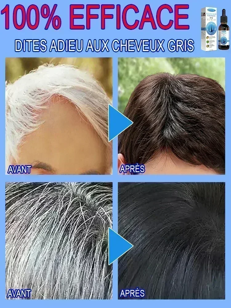 Anti-Grey cabelo soro tratamento, restaurar, impedir o cabelo, nós branco, Ahair em preto, saudável, cor natural